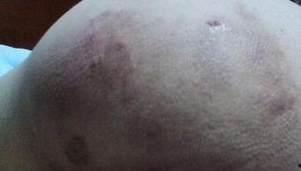 吃瓜徐猫癣,揭秘网络红人的崛起与争议