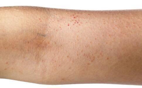 吃瓜徐猫癣,揭秘网络红人的崛起与争议